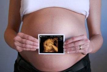 3д узи при беременности: преимущества и недостатки, фото, видео процедуры