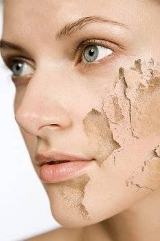 Шелушение кожи лица, причины появления и способы избавления