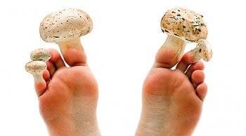 Лекарства и народные методы, которые помогут избавиться от грибка ногтей
