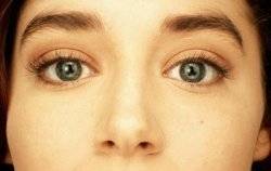 Катаракта глаза - причины, симптомы и стадии, лечение