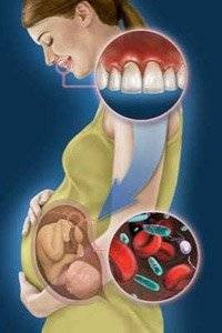Лечение и удаление зубов во время беременности