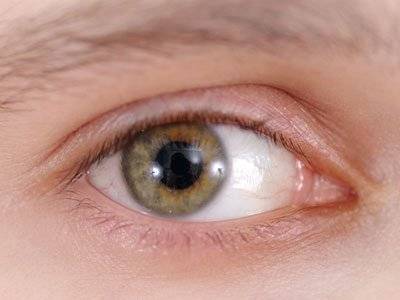 Почему бывает покраснение вокруг глаз, способы устранения